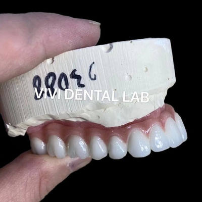 자연스러운 외모 에스테틱 나사 유지 Zirconia 임플란트 왕관 오래 지속