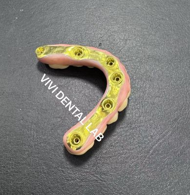 티타늄 막대기 지원과 함께 전체 지르코니아 브리지 중국 치과 연구소