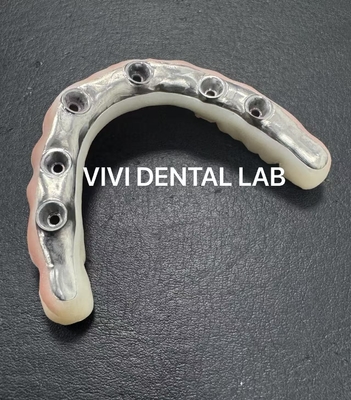 중국 VIVI DENTAI LABORATORY 인증
