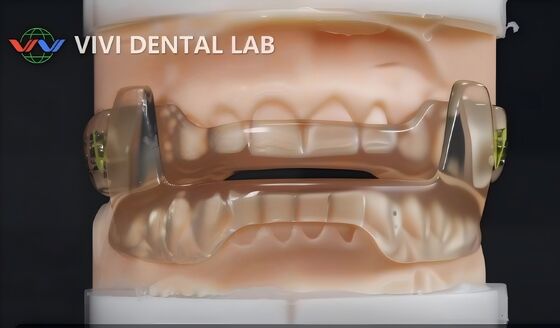 중국 VIVI DENTAI LABORATORY 인증