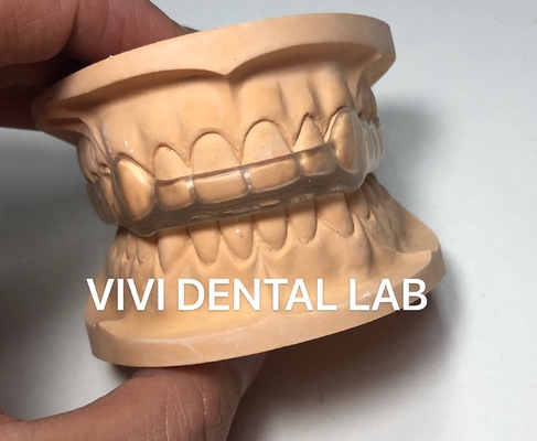 중국 VIVI DENTAI LABORATORY 인증