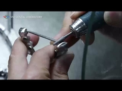 PFM 왕관과 다리