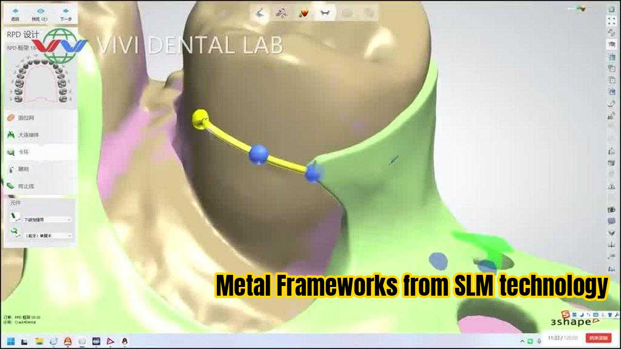 중국 VIVI DENTAI LABORATORY 인증